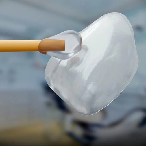 Up-close view of bonding agent putting veneer in place