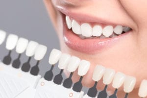 Teeth Whitening Springfield & Longmeadow, MA 