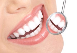 Teeth whitening in Springfield, Ludlow & Westfield, MA